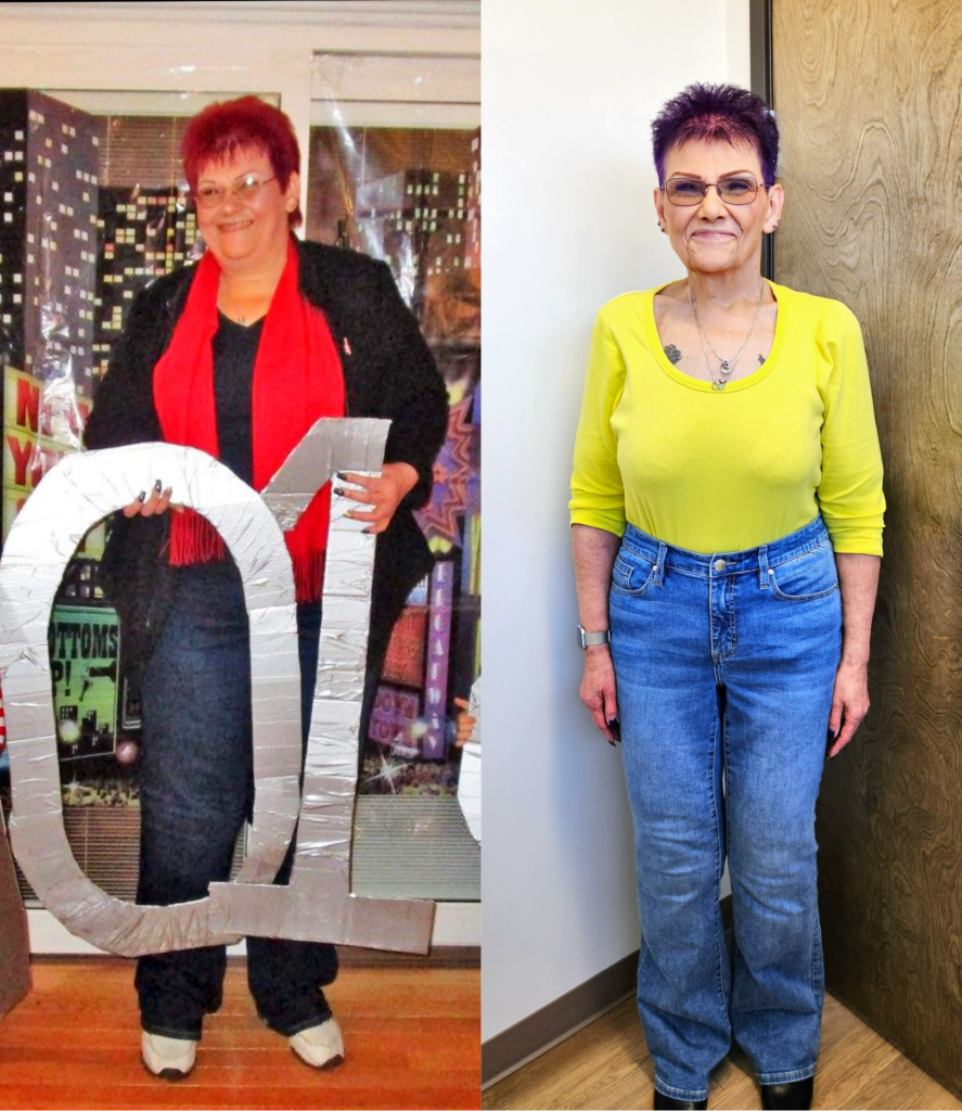 Patient before and after results from medical weight loss program at Michigan Weight Loss Institute.