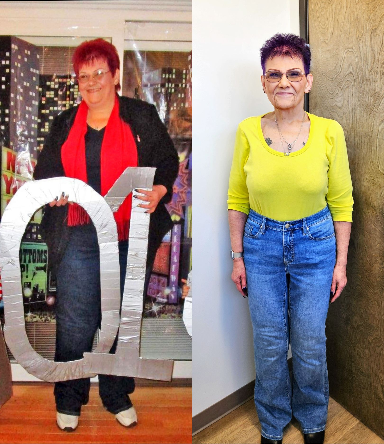 Patient before and after results from medical weight loss program at Michigan Weight Loss Institute.