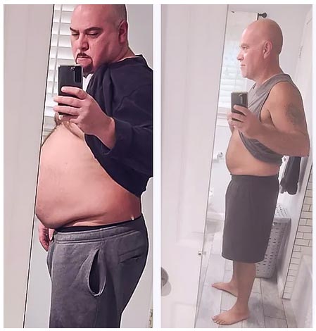 Patient weight loss transformation before and after — result 2