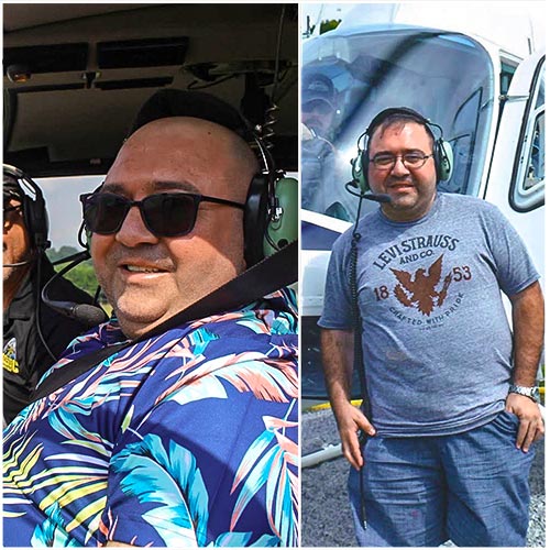 Patient weight loss transformation before and after — result 3