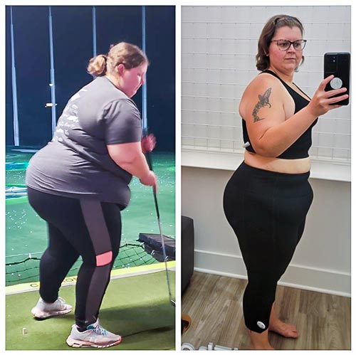 Patient weight loss transformation before and after — result 4