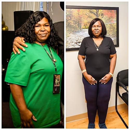 Patient weight loss transformation before and after — result 5