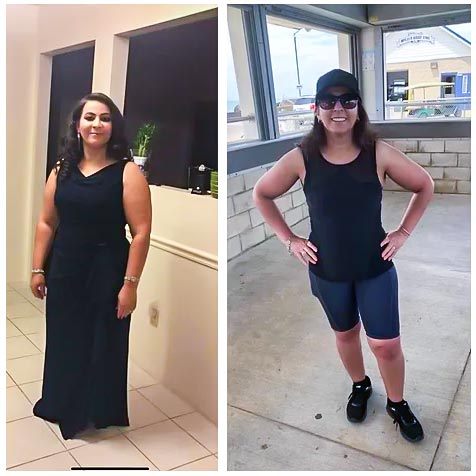 Patient weight loss transformation before and after — result 6