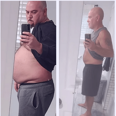 Weight Loss Before and After