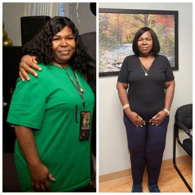 Weight Loss Before and After