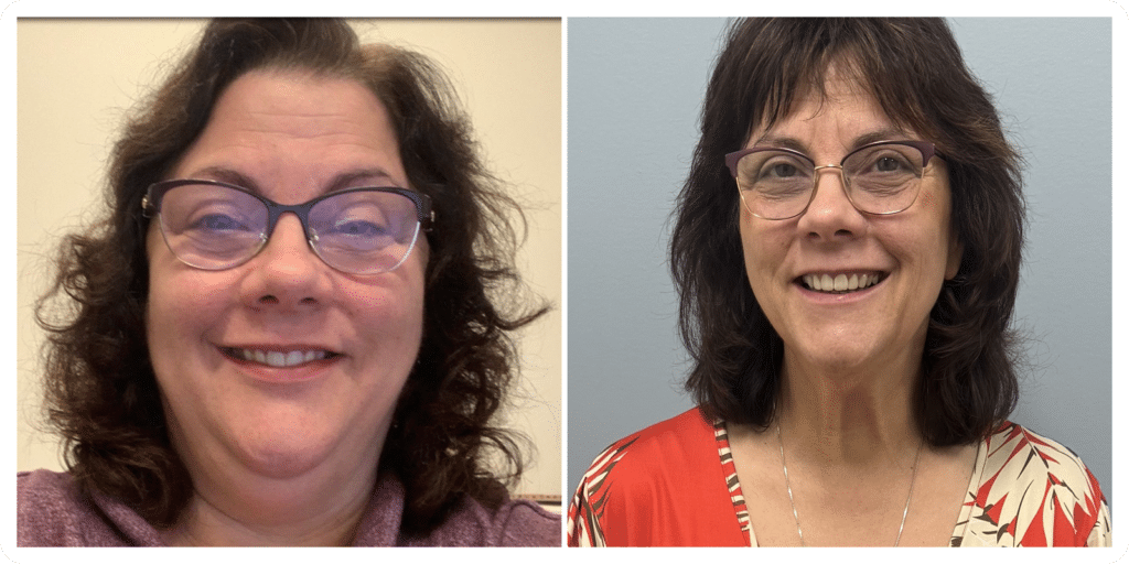 Side-by-side before-and-after portraits of a patient following weight loss and three Morpheus8 treatments to the neck.