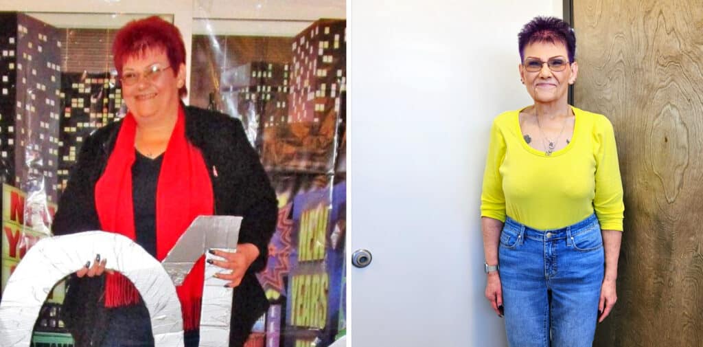 Before and After Weight Loss Transformations